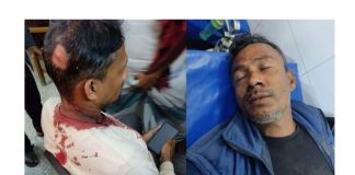 লৌহজংয়ের নাগের হাটে অতিথি পাখি শিকারে বাধা দেয়ায় পিটিয়ে আহত
