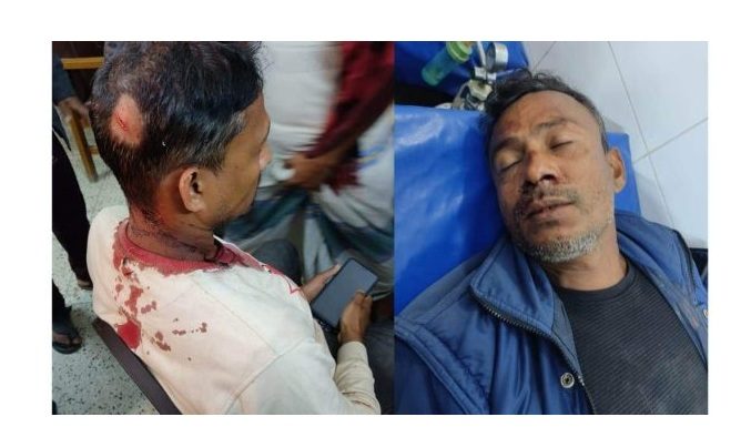 লৌহজংয়ের নাগের হাটে অতিথি পাখি শিকারে বাধা দেয়ায় পিটিয়ে আহত