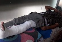 টঙ্গীবাড়ীতে সড়ক দূর্ঘটনায় বিদারুল আহত