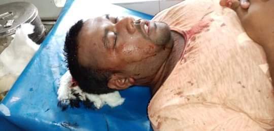 সিরাজদিখানে প্রতিবেশীর লাঠির আঘাতে ছাত্রলীগ নেতার মাথায় ১১ সেলাই, কে ফাটিয়েছে দেখনি কেউ